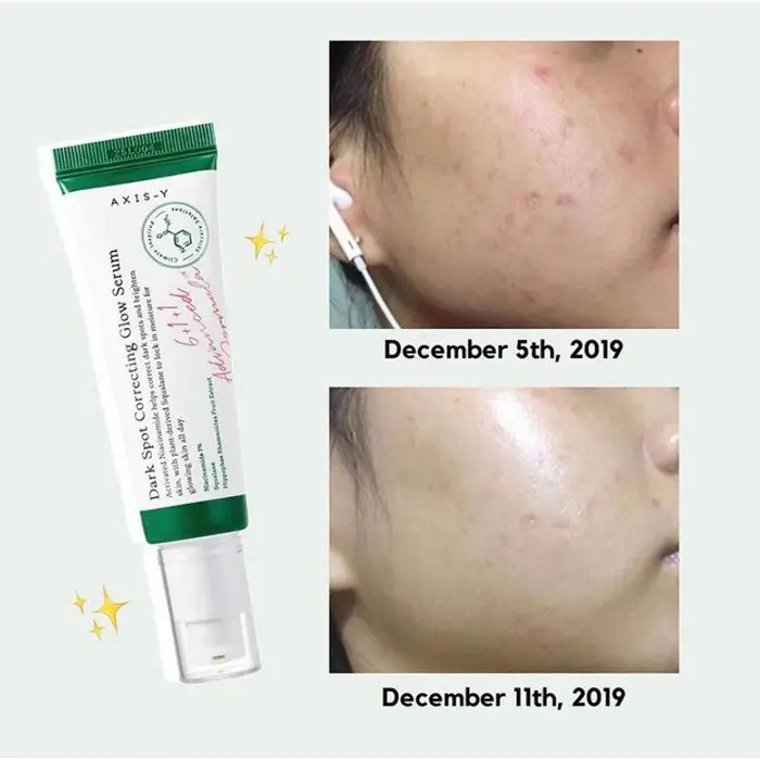 ضدلک و ضدجوش و روشن کننده