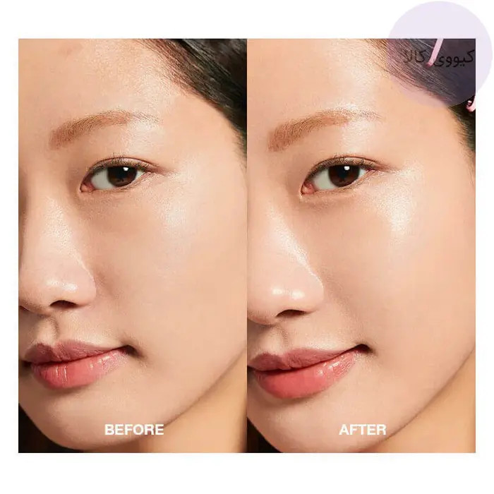 آرام بخش و تسکین دهنده پوست